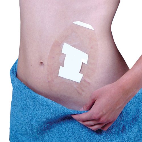 SEAL-TIGHT Shield (Pk/5) Dressing & Wound Protector - Best Medical Supplies Online