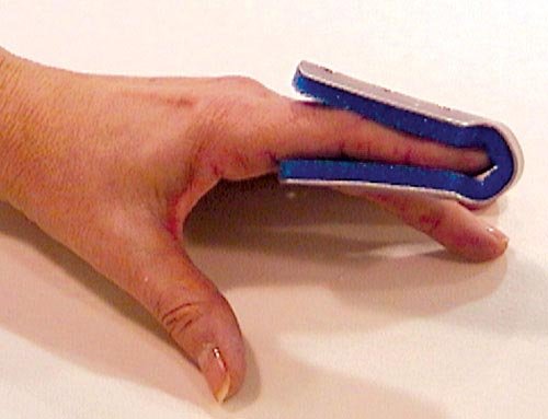 Fold Over Finger Splint Small Bulk PK/6 Non-Retail