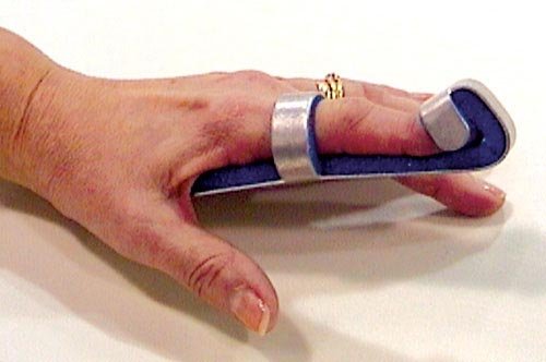 Baseball Finger Splint Small Bulk PK/6 Non-Retail