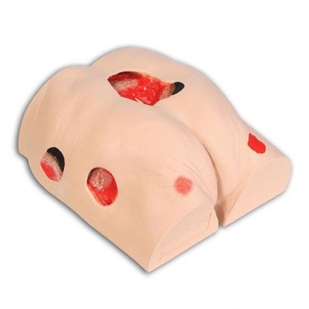 Seymour II Decubitus Wound Care Model - Best Medical Supplies Online